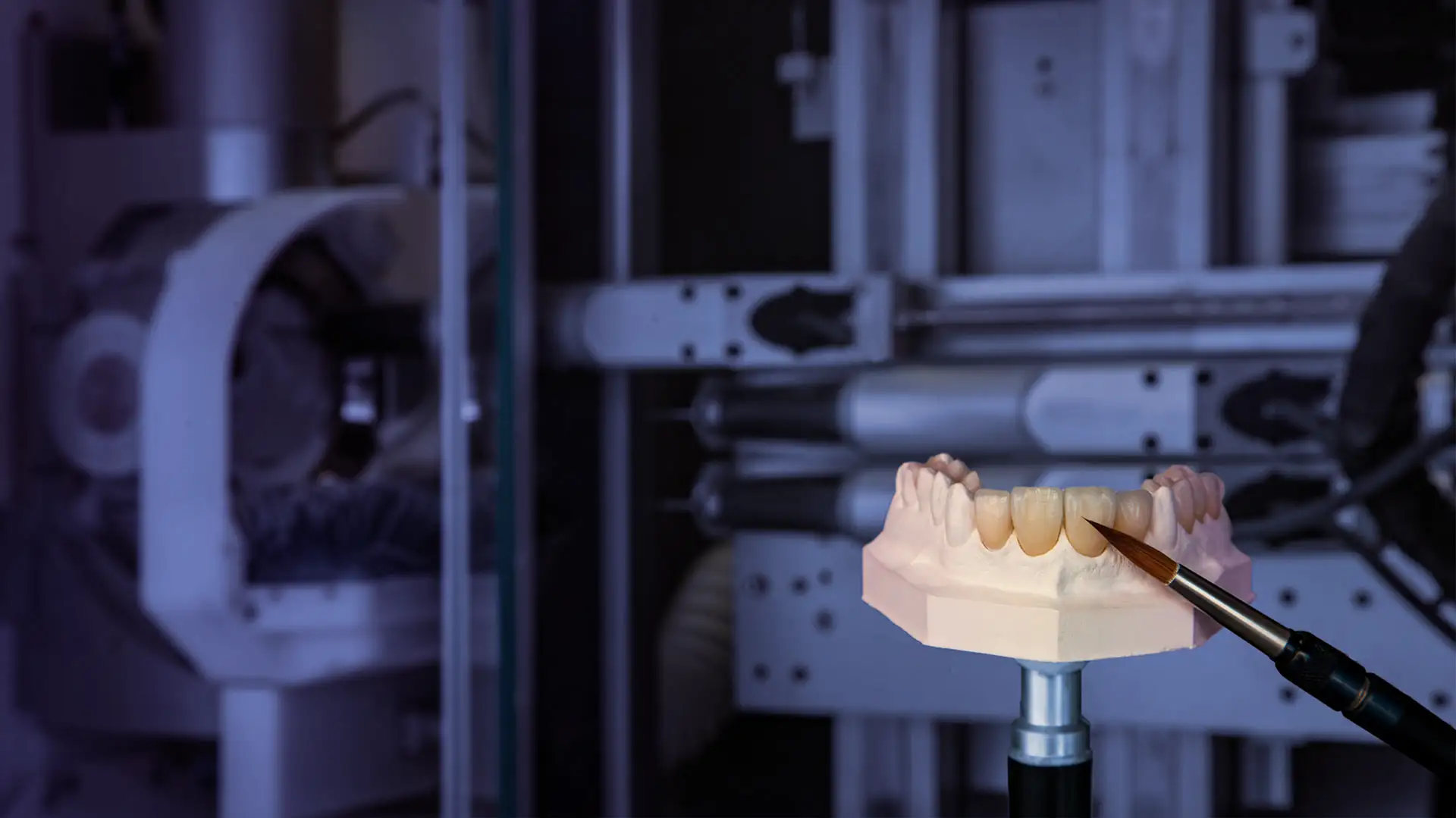 Prótesis Dental