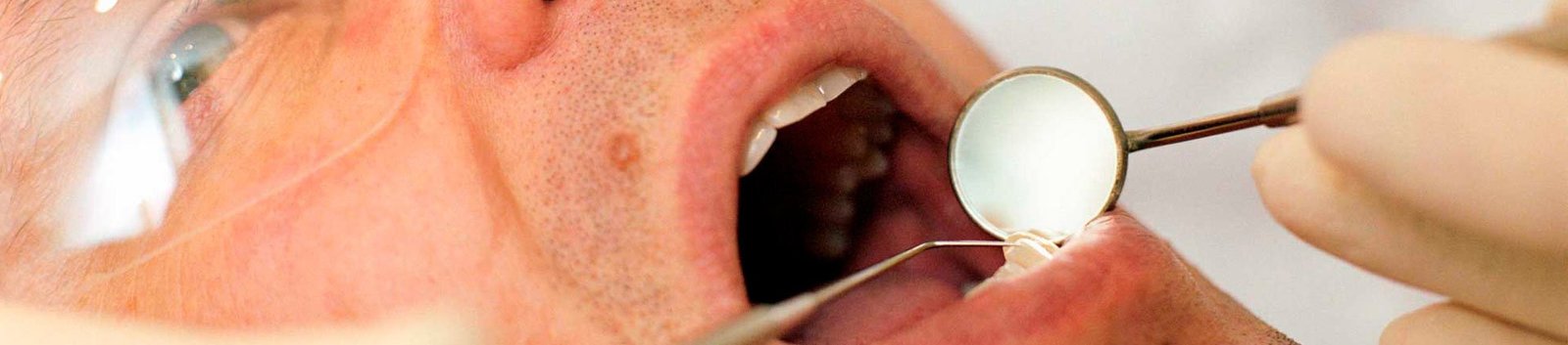 Exploración Bucodental