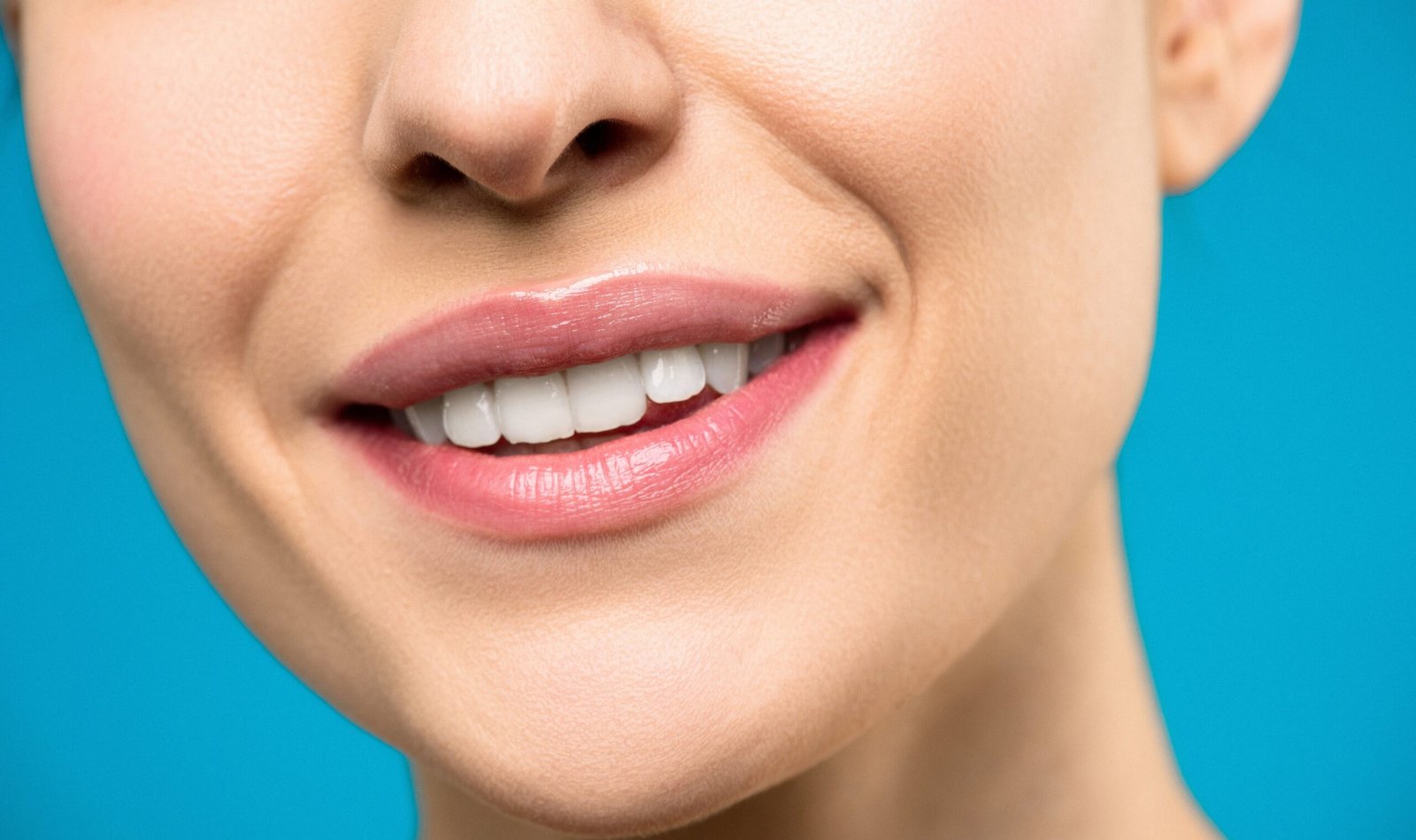 blanqueamiento dental