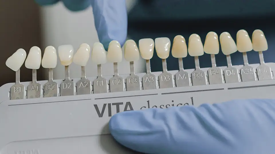 El Color Natural de los Dientes 