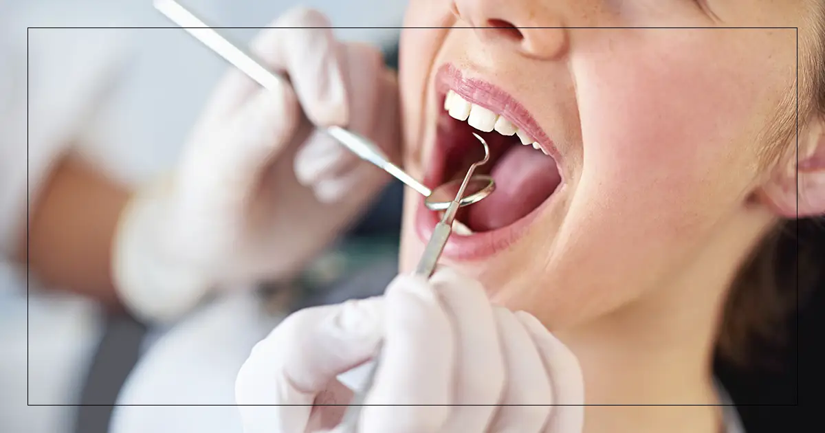 Revisión de Caries Dental