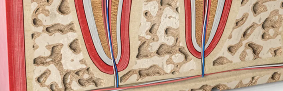 Apicetomía en Look Dental