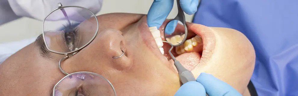 Reconstrucciones Dentales de Composite